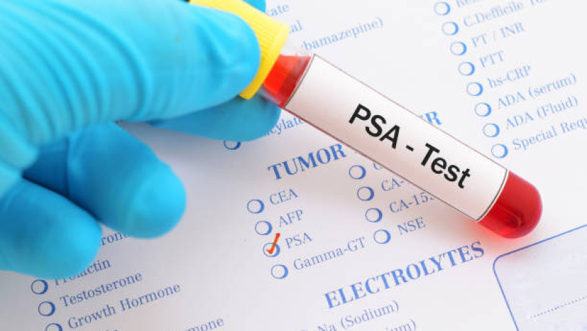PSA Test Image